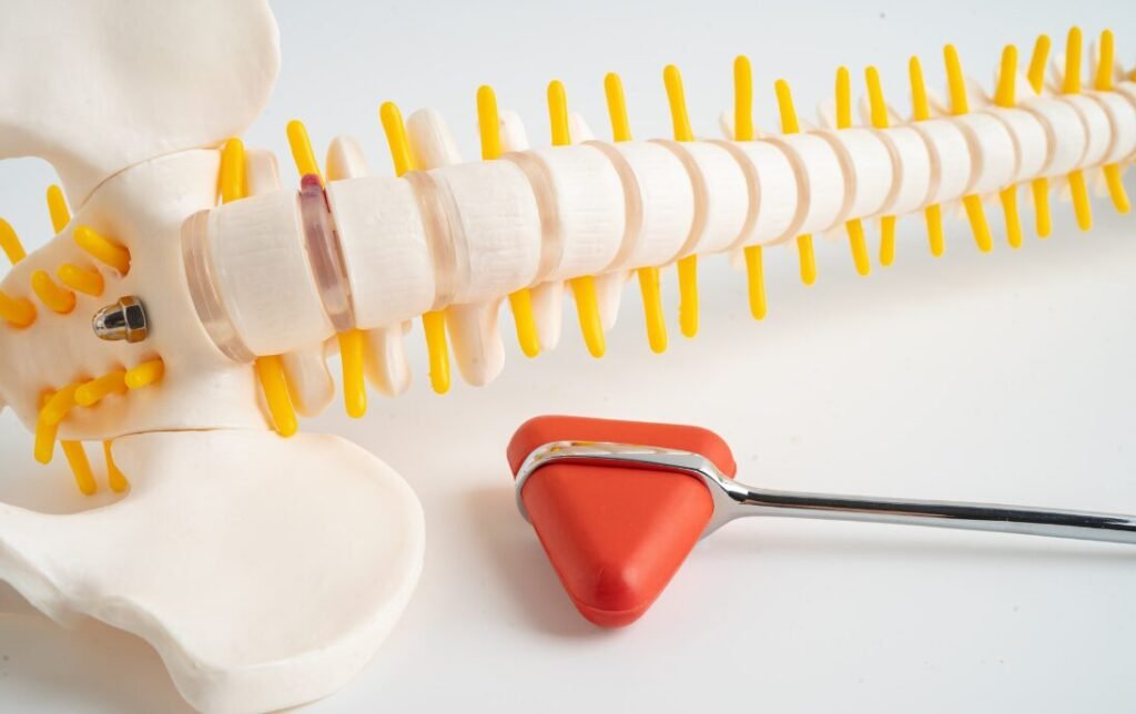 Lumbar-Spondylosis.PNG-1