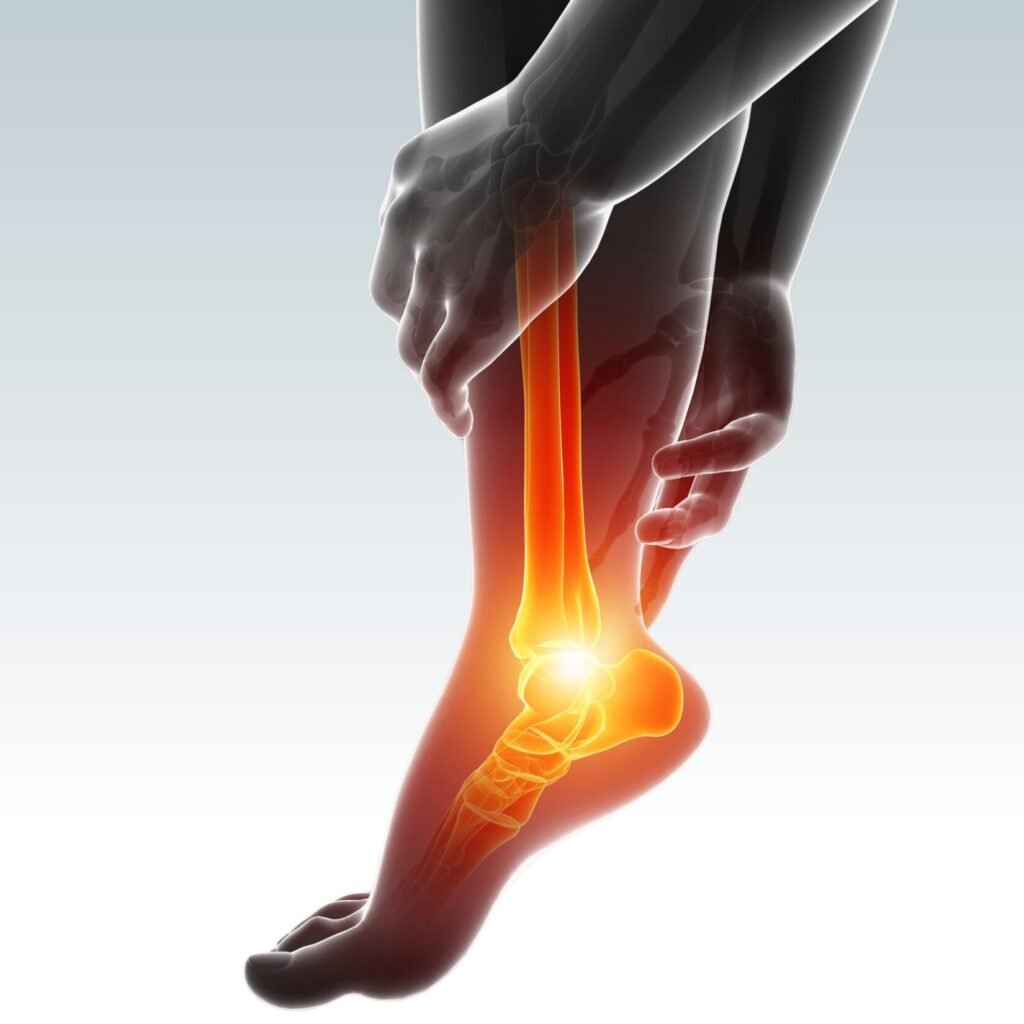 Heel Pain - Dr Sumit vishwakarma
